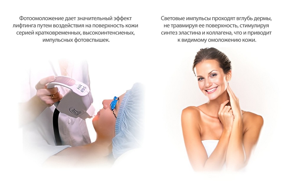 Фотоомоложение Lumenis M22