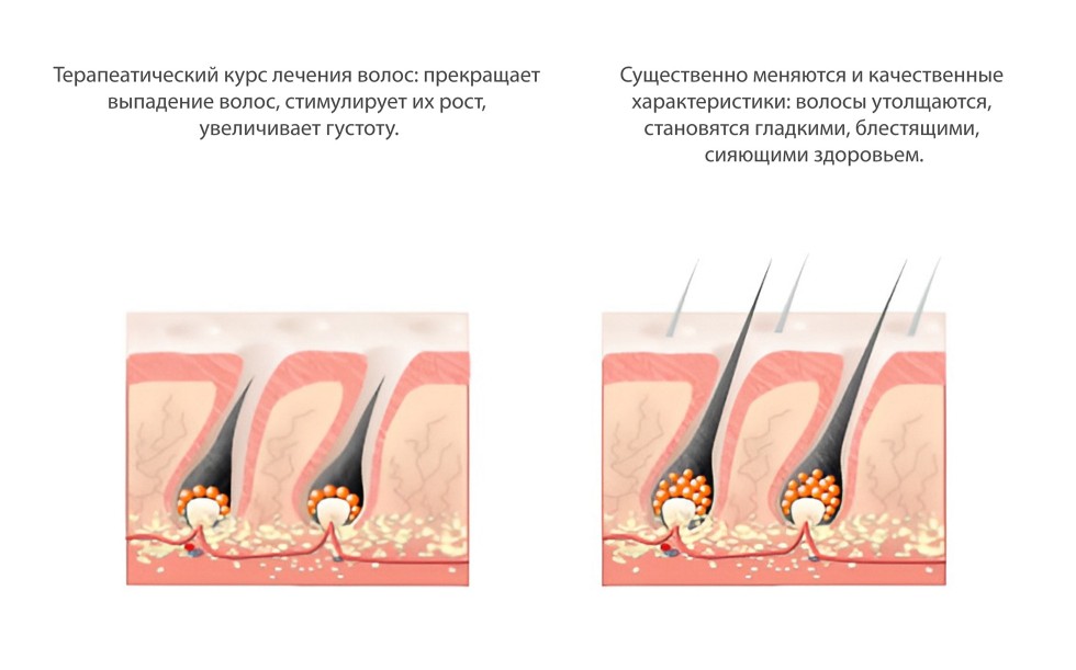 Программа стимуляции роста волос