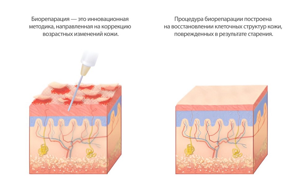 Биорепарация
