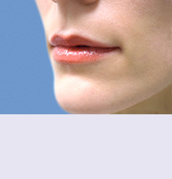 Контурная пластика до | пациент 99